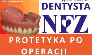 Protezy zębowe NFZ: gwarancja na protetykę po operacji. Zobacz, jak wygląda nowoczesna proteza.