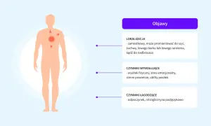 Schemat objawów bólu zamostkowego, promieniującego do szyi, żuchwy, barku lub ramienia. Czynniki wywołujące i łagodzące.