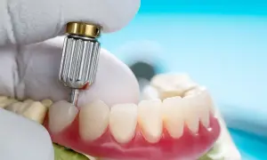 Dentyści pracują nad sztucznymi zębami na NFZ. Zbliżenie na protezę i narzędzie.