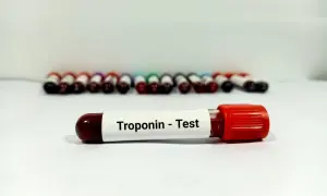 Troponina - co to za badanie i jak wpływa na zdrowie serca?