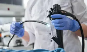 Lekarz w niebieskich rękawiczkach trzyma gastroskop. Badanie gastroskopia ze znieczuleniem NFZ.