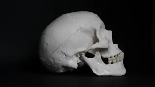 Model czaszki z widocznym nacięciem sugerującym trepanację czaszki, na ciemnym tle.