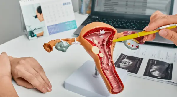 Model macicy z zaznaczonym polipem endometrialnym. Lekarz wyjaśnia pacjentce budowę narządu.