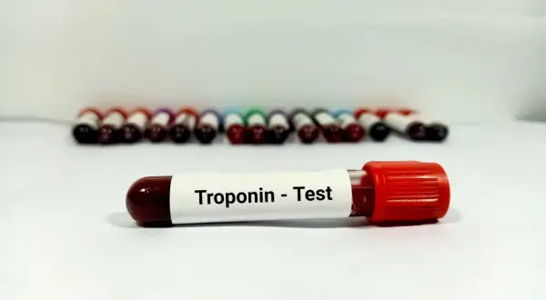 Troponina - co to za badanie i jak wpływa na zdrowie serca?