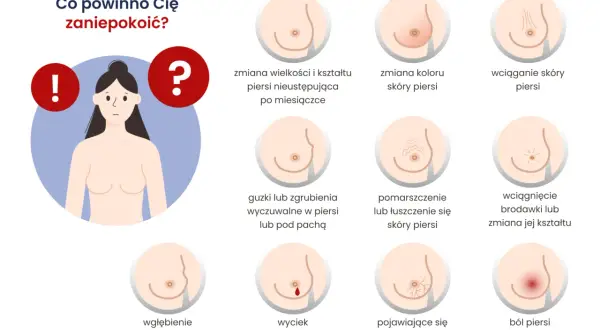 Grafika przedstawia objawy raka piersi: zmiany wielkości, koloru, wciąganie skóry, guzki, wyciek z brodawki, ból.