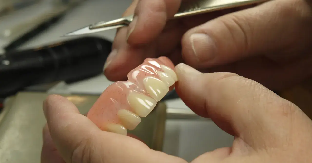 Dłoń trzyma protezę na implantach NFZ, gotową do dopasowania.