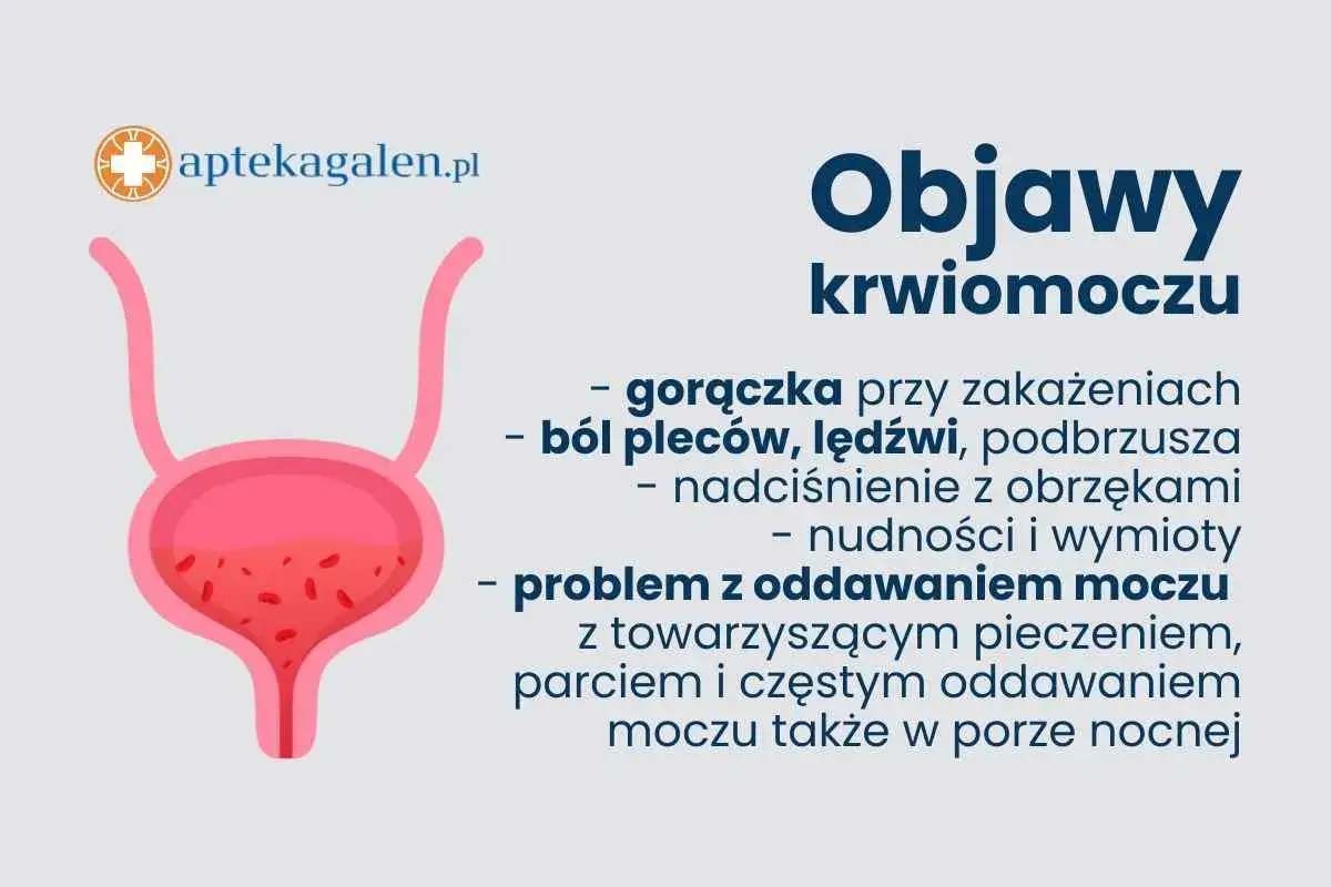Grafika przedstawia pęcherz moczowy z widocznymi czerwonymi elementami, symbolizującymi krew. Obok wypisano objawy krwiomoczu.