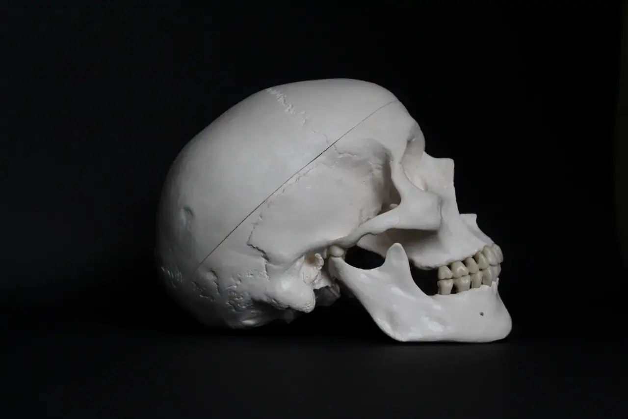 Model czaszki z widocznym nacięciem sugerującym trepanację czaszki, na ciemnym tle.