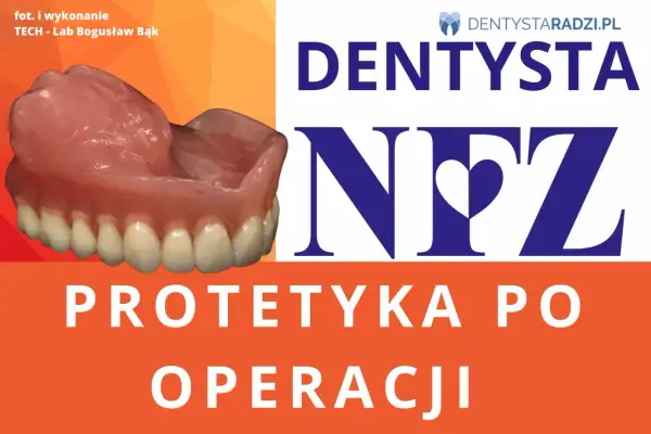 Protezy zębowe NFZ: gwarancja na protetykę po operacji. Zobacz, jak wygląda nowoczesna proteza.